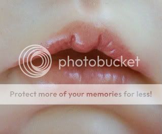 lips